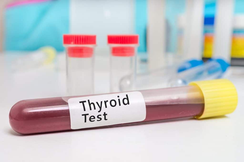 1013_Thyroid Disease_Mod 2_Opt 2_Blood sample