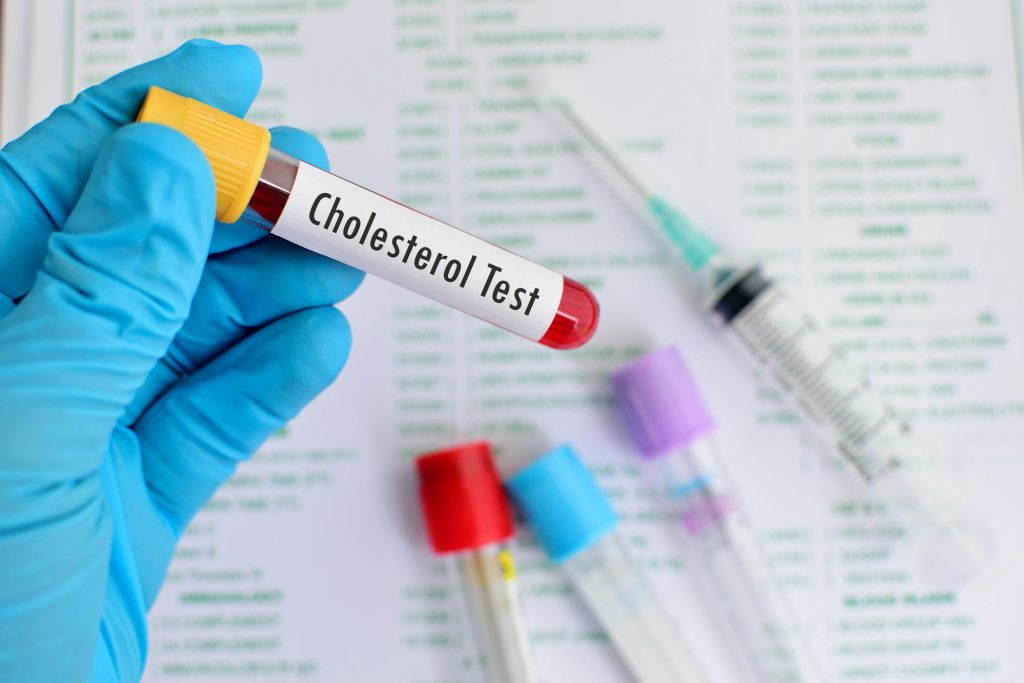 109_Cholesterol Lipid Panel_Mod 2_Blood sample for cholesterol