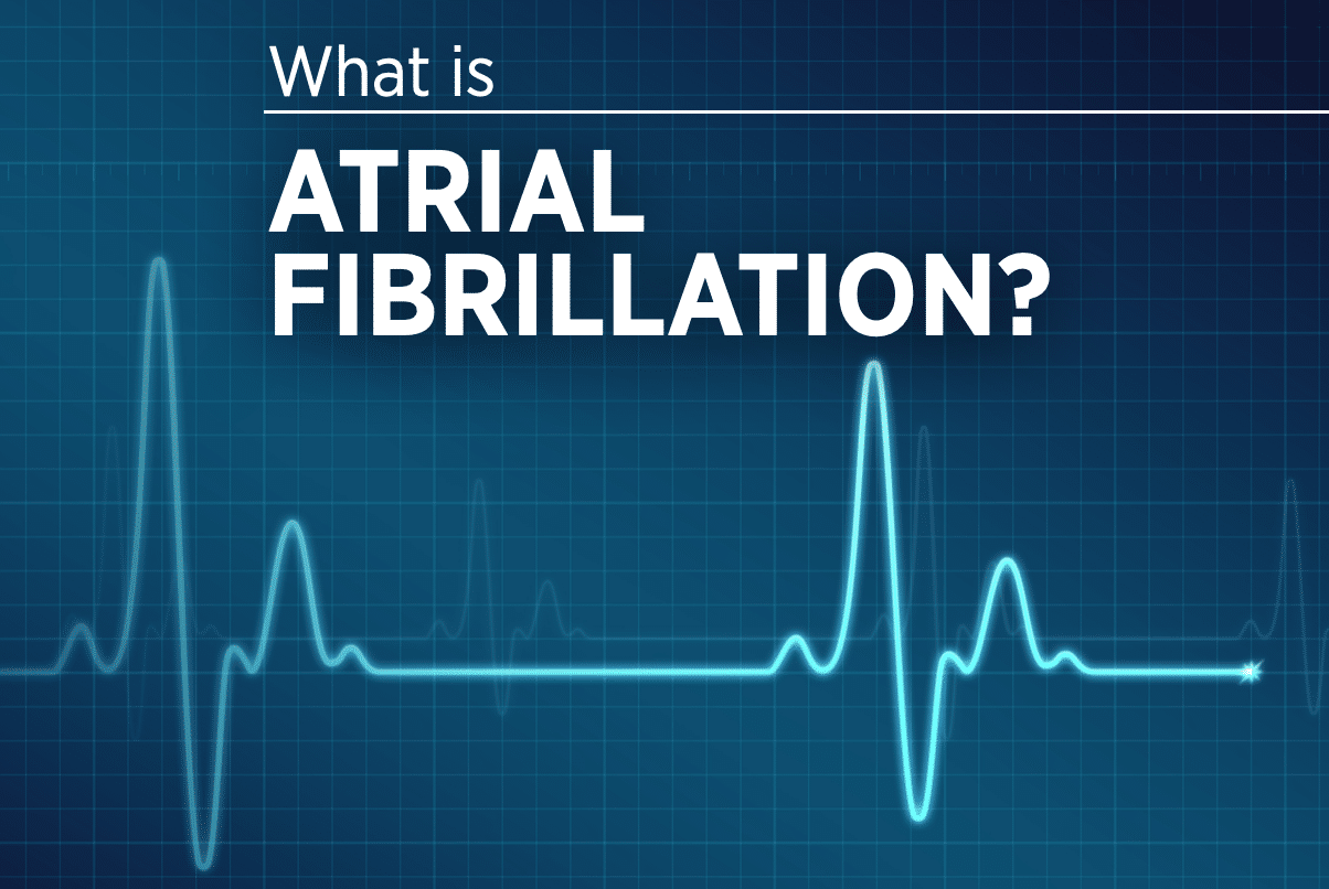 What is Atrial Fibrillation_ - Life Line Screening