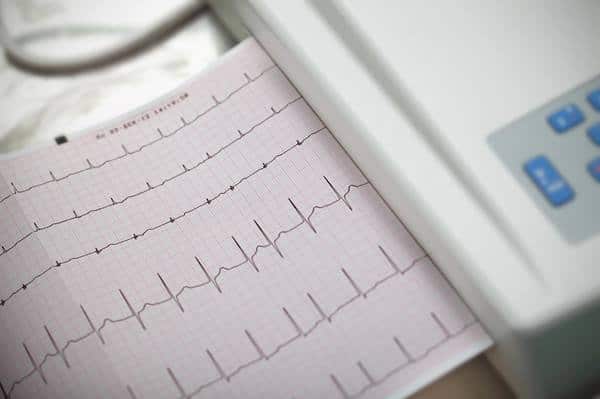 afib strip with machine