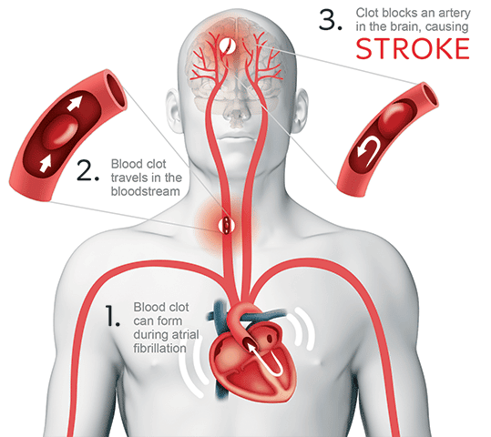 The Skeptical Cardiologist